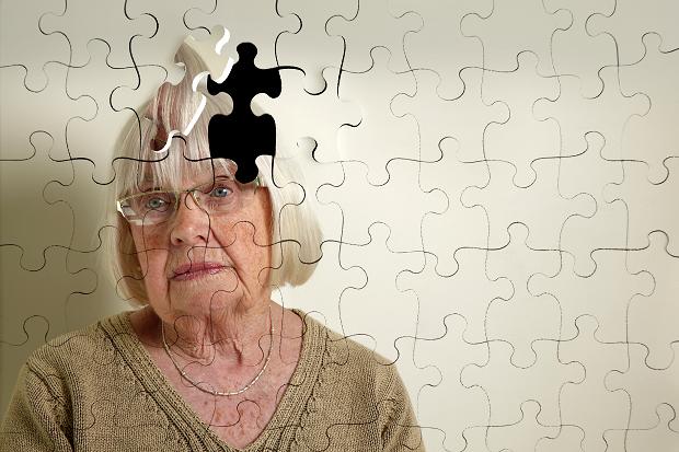 Alzheimer’s: 10 Warning Signs